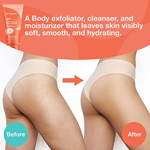KP Bump Eraser Body Scrub, Exfoliating Body Scrub, Strawberry Legs Treatment, Exfoliating Body Wash, Body Scrubs for Women Exfoliation, Keratosis Pilaris Treatment
