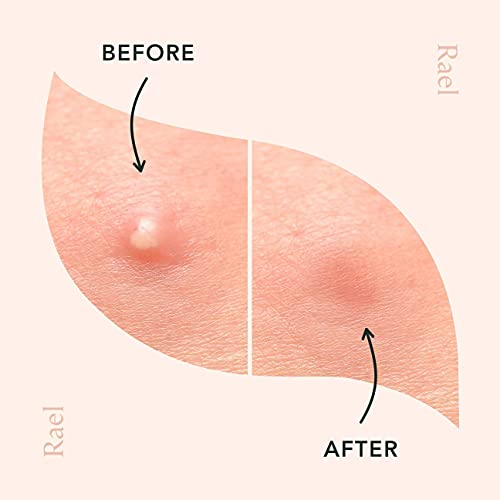 Rael Miracle Invisible Spot Cover - Absorbing Cover, Skin Care, Facial Stickers, 2 Sizes (96 Count)