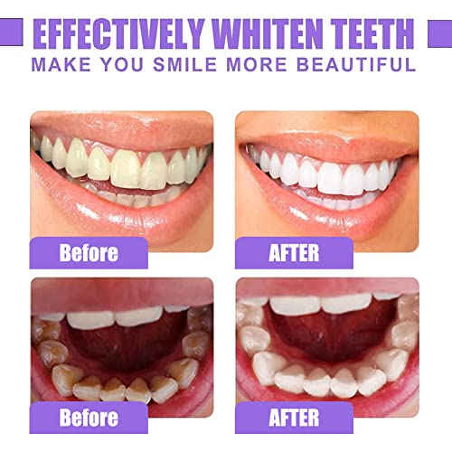 Purple Toothpaste, Teeth Whitening Sensitive Teeth Toothpaste, Purple Teeth Whitening, Tooth Stain Removal, Deeply Cleaning Gums, Stain Removal, Brightness &Reduce Yellowin, 30ml