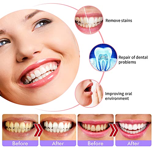 Purple Toothpaste, Teeth Whitening Sensitive Teeth Toothpaste, Purple Teeth Whitening, Tooth Stain Removal, Deeply Cleaning Gums, Stain Removal, Brightness &Reduce Yellowin, 30ml