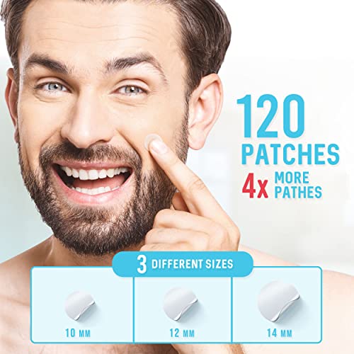 KEYCONCEPTS Pimple Patches (120 Pack), Hydrocolloid Patches - Pimple Patches for Face - Zit Patch and Pimple Stickers - Hydrocolloid Pimple Dots for Pimple - Pimple Patch - Pore Strips