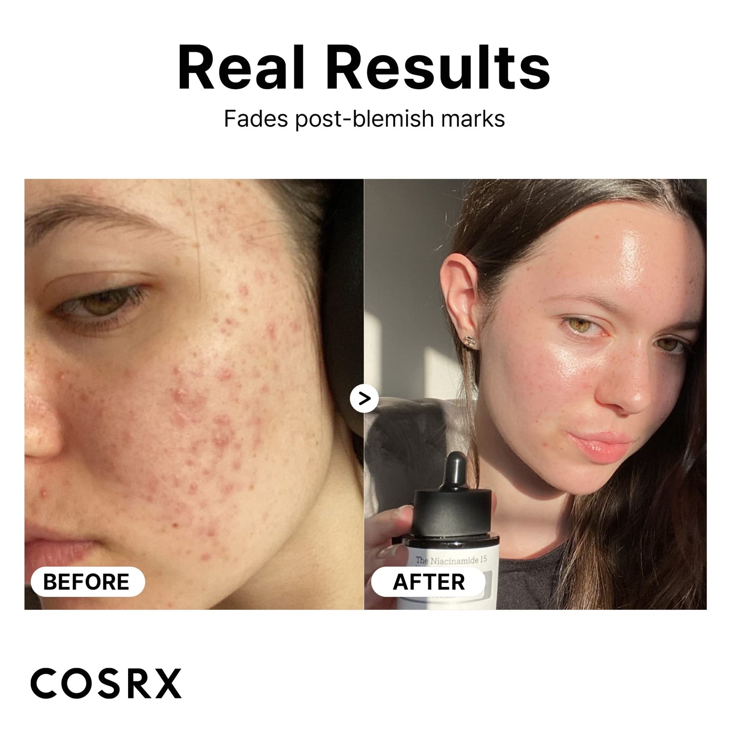 Pre-Order | Arrives in 5–10 Days – COSRX 15% Niacinamide Face Serum, 0.67 fl oz, Pore Minimizer Serum for Face, Even Skin Tone, Korean Skin Care