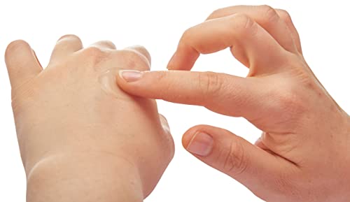 Pre-Order | Arrives in 5–10 Days – After Bite Gel Insect Bite Treatment, Portable Bug Bite Itch Relief