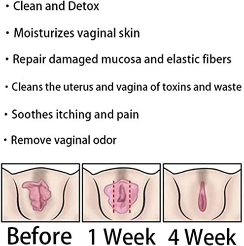 Pre-Order | Arrives in 5–10 Days – DASHENRAN Annie Care Natural Detox Viginal Gel, Anniecare Instant Anti-Itch Detox Slimming Products, Annie Care Natural Detox Viginal Capsules, Natural Repair Vajinal Capsules (8Box)