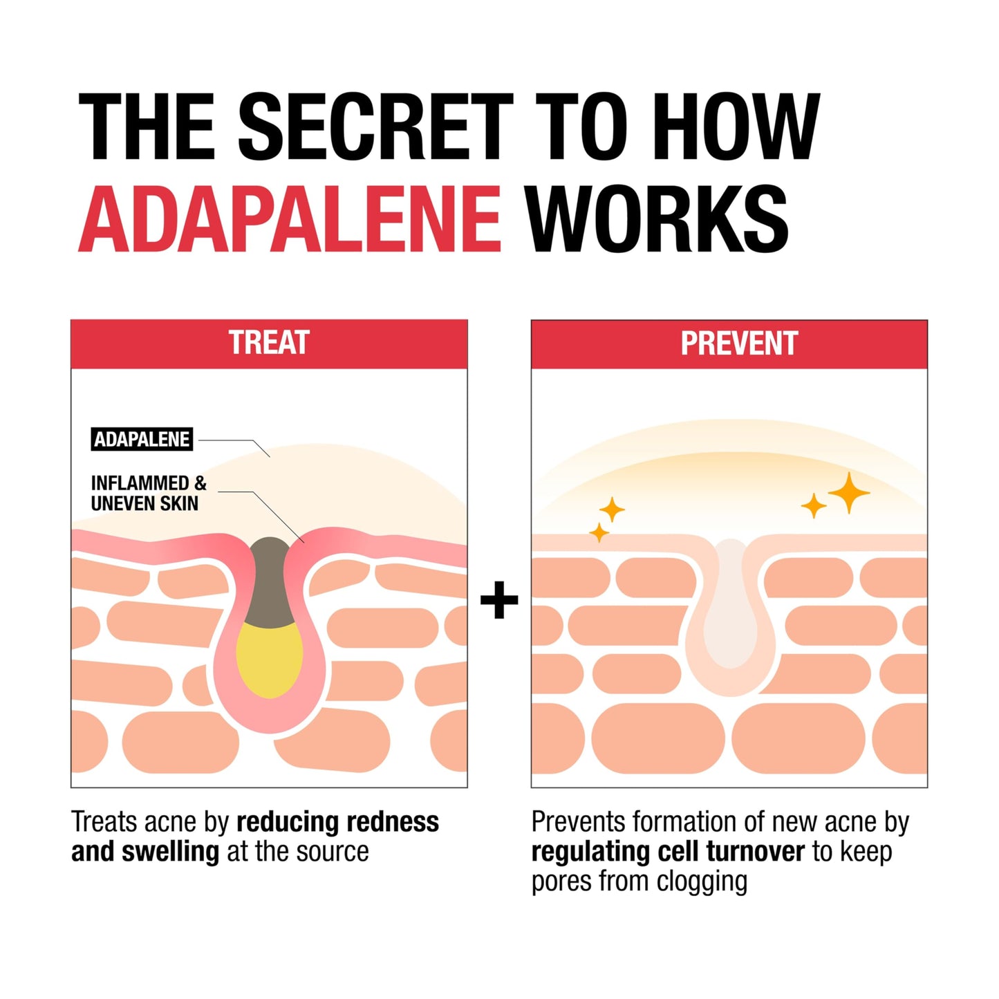 Neutrogena 0.1% Adapalene Gel Acne Treatment, Topical for Acne, Adapalene Medication for Blemishes, Once Daily Topical Retinoid to Prevent Breakouts, Oil & Fragrance-Free, 1.6 oz