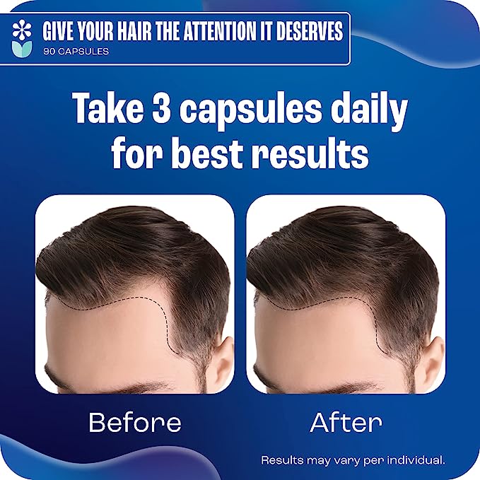 Hair Growth for Men - Hair Vitamins for Men, Hair Growth Vitamins for Men - Hair Supplements for Hair Growth Men - Biotin for Men, Hair Growth Men, Hair Regrowth for Men - Mens Hair Growth Products